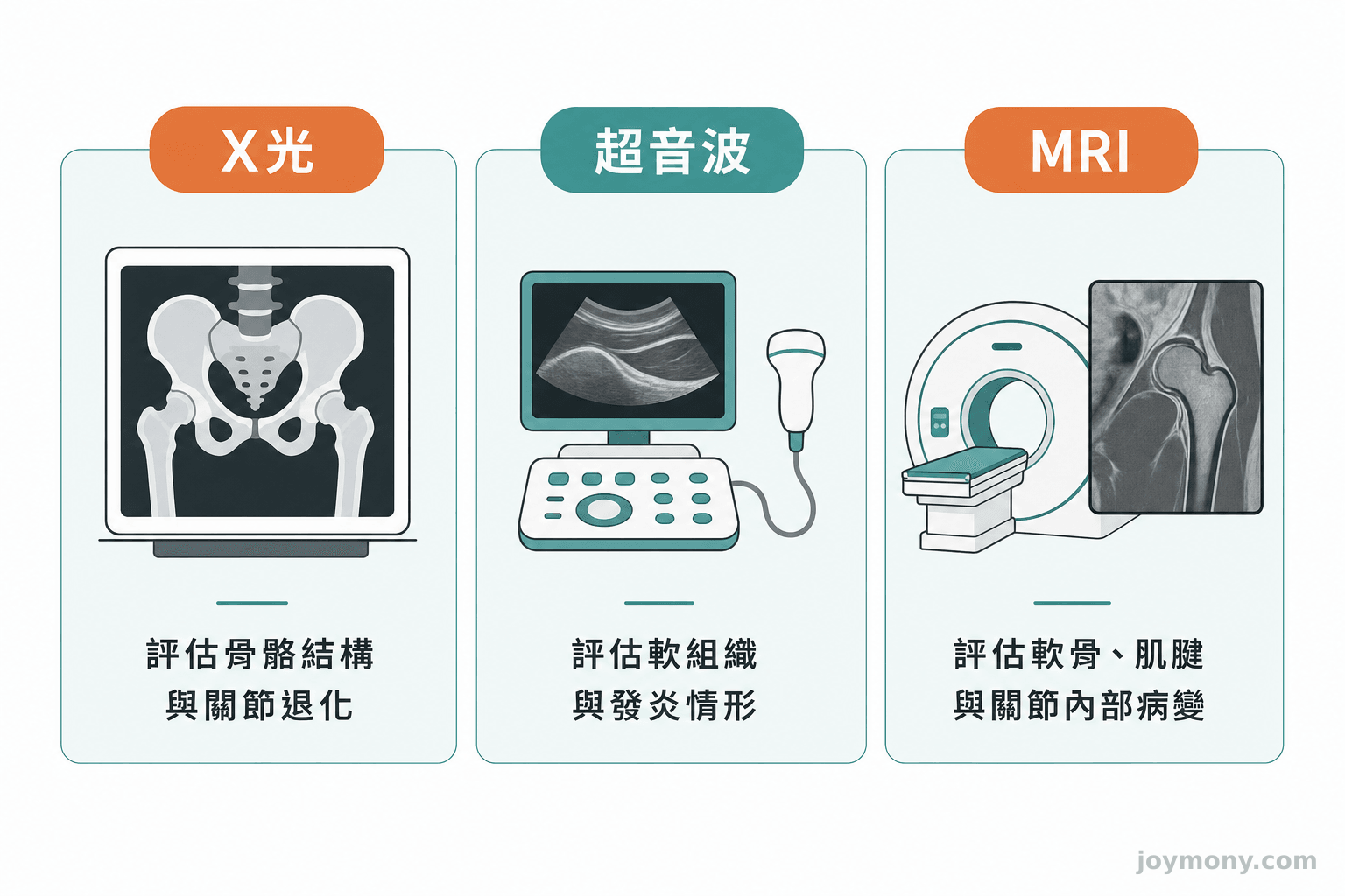 X光、超音波、MRI 在髖部疼痛檢查中各自負責的任務示意圖